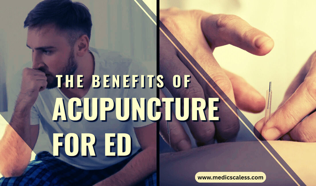 The Benefits of Acupuncture for ED
