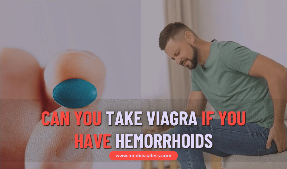 Can You Take Viagra if You Have Hemorrhoids?