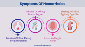 Symptoms Of Hemorrhoids